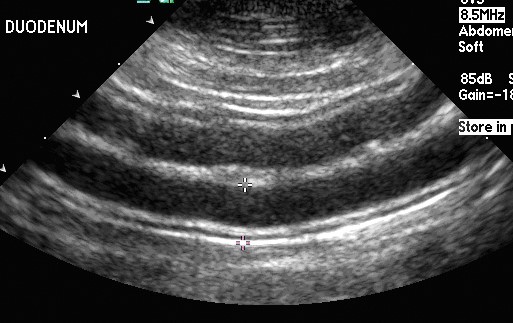 Me near ultrasound scan Baby Scan